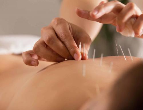 ¿Qué cubren los seguros de salud en terapias alternativas como acupuntura o homeopatía?